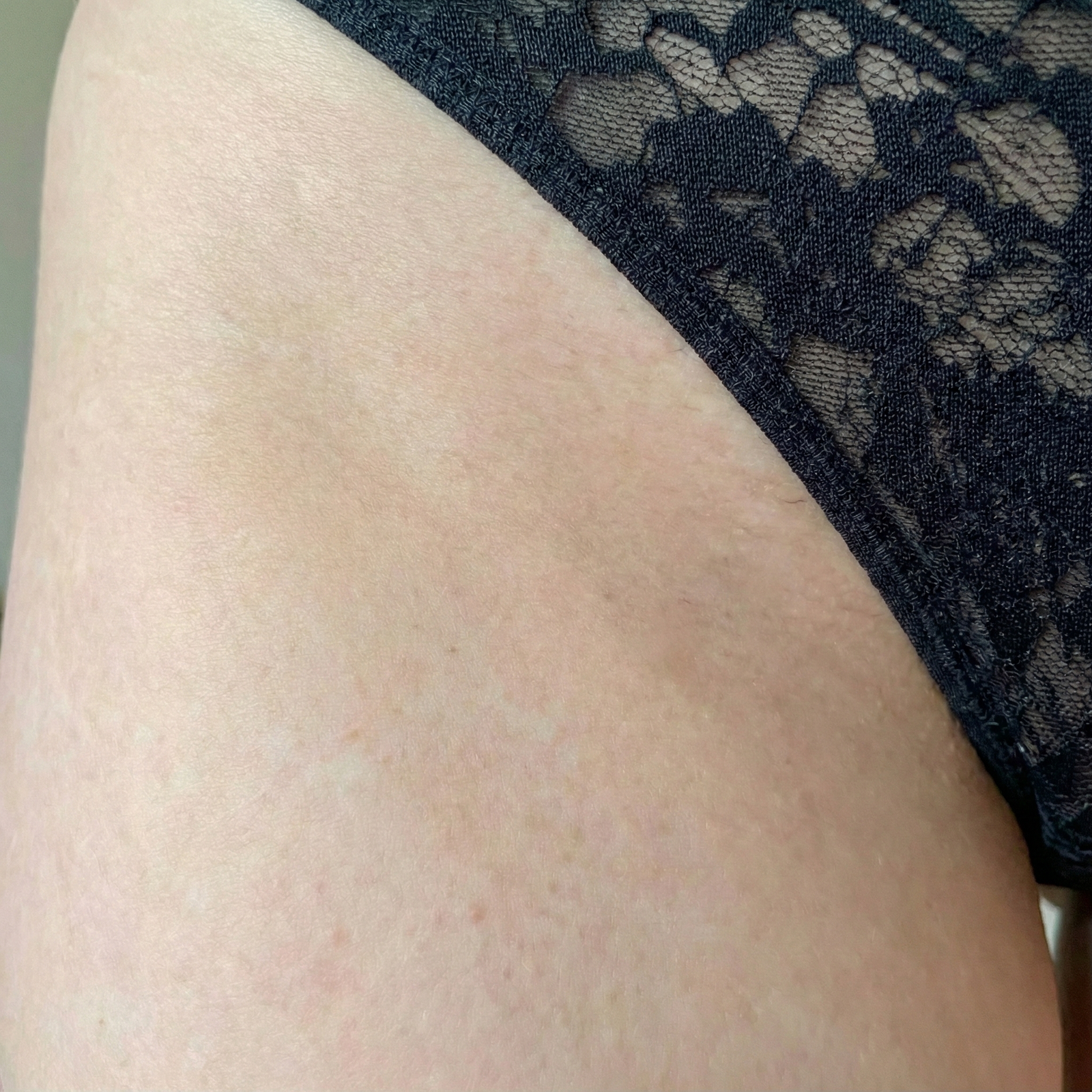 Dopo